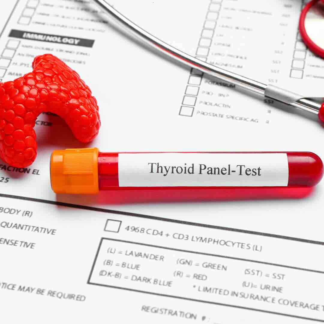 Functional Medicine Testing